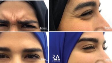 حوار مع دكتور الأمراض الجلديَّة والتّجميل رامي عبادي
